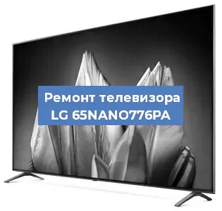 Замена материнской платы на телевизоре LG 65NANO776PA в Воронеже